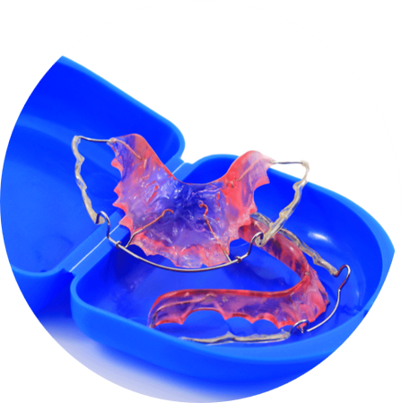 Removable Retainers
